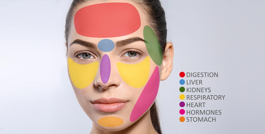 forehead acne causes