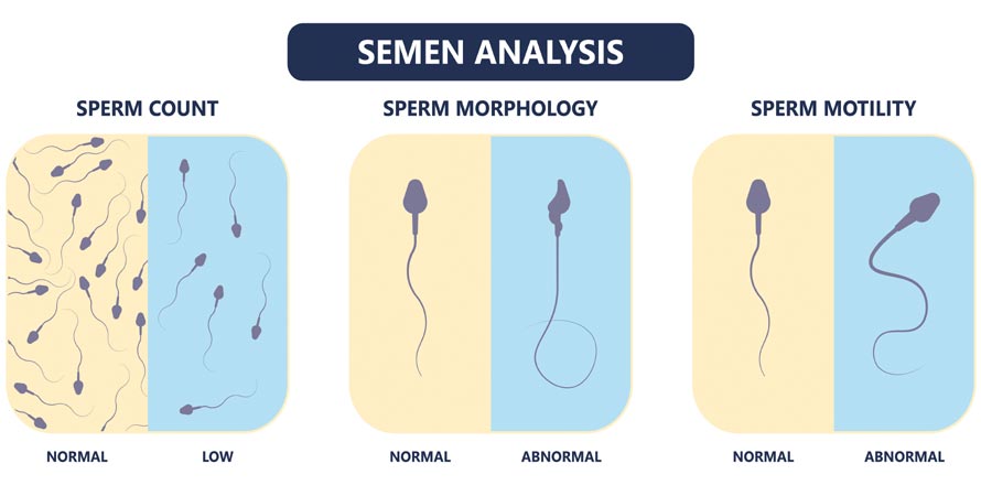 Semen Analysis
