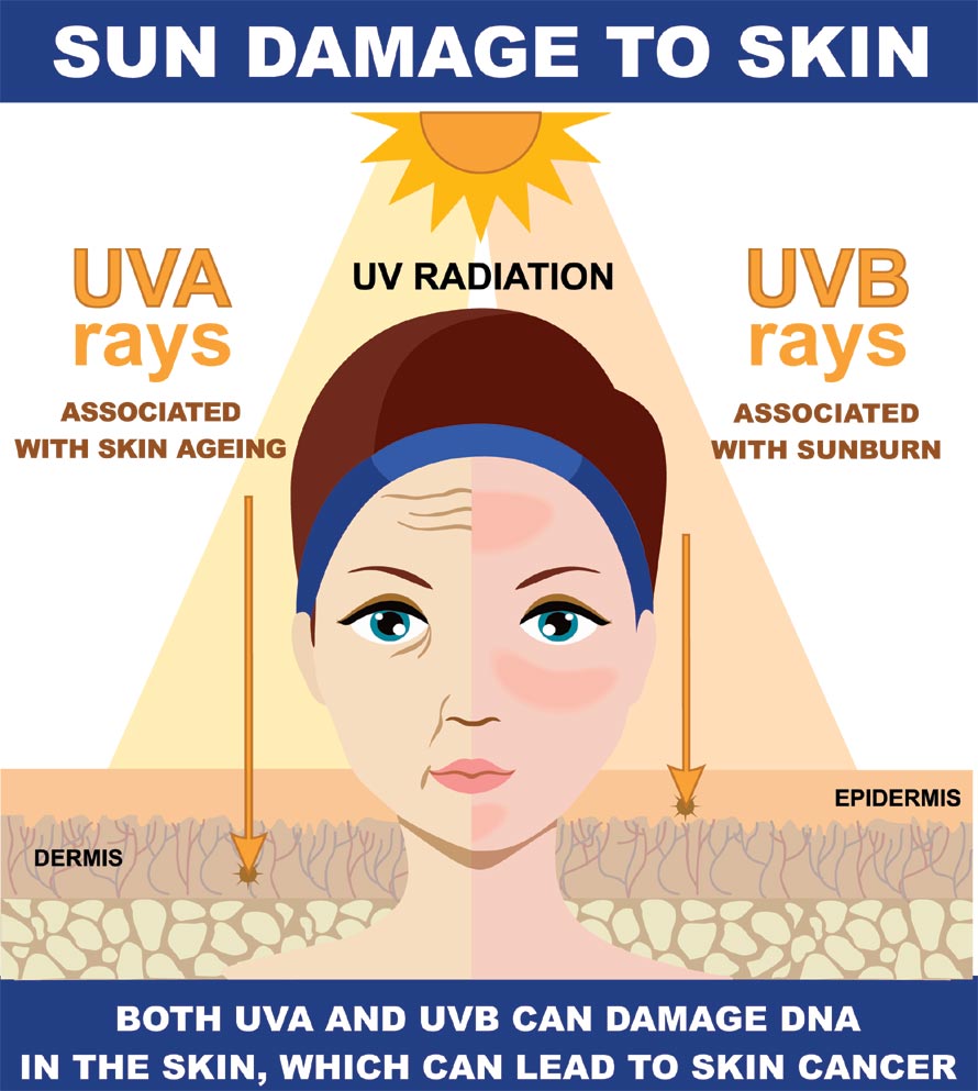Causes Skin Tanning