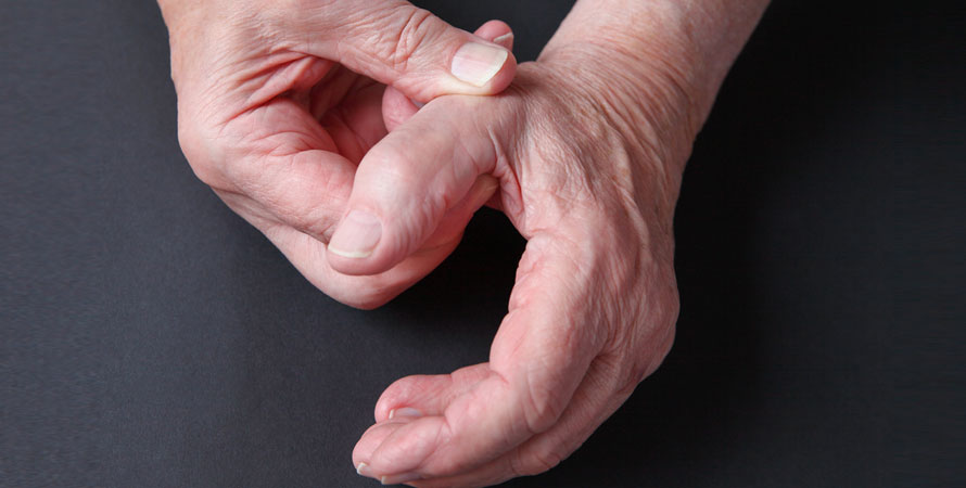 Thumb Arthritis