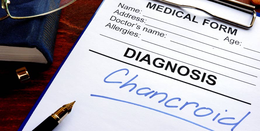 chancroid treatment