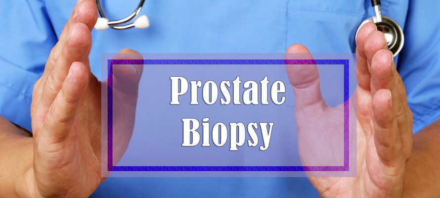 Prostate Biopsy