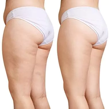 Cellmaxa Before After