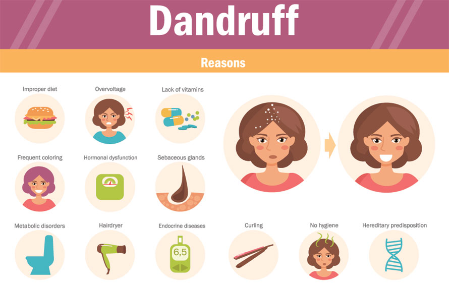 Dandruff