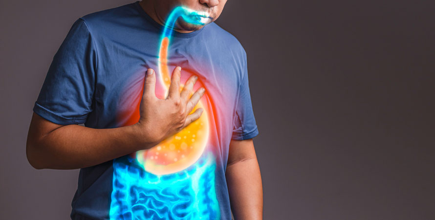 Symptoms of Acid Reflux and GERD