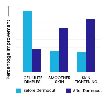 Dermacut Graph2